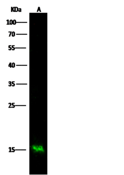 Anti-S100A9 Monoclonal Recombinant Antibody