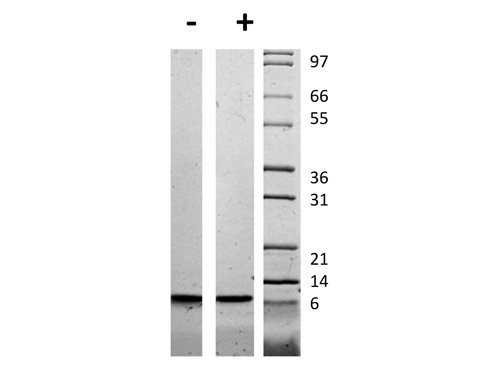 Insulin-like Growth Factor II