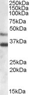 Anti-ARSB, Internal