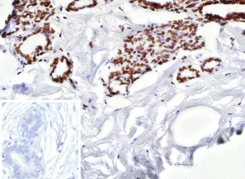 Anti-ESR2 / Estrogen Receptor beta, clone ESR2/9710