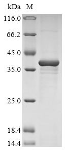Nucleotide-binding oligomerization domain-containing protein 2 (NOD2), partial, bovine, recombinant