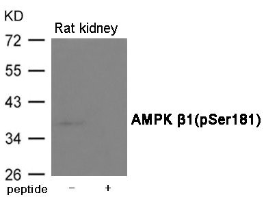 Anti-Phospho-PRKAB1 (Ser181)