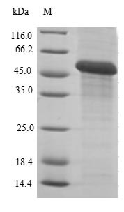 Carbonyl reductase [NADPH] 1 (CBR1), human, recombinant