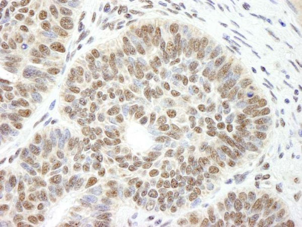 Anti-CCAR1 (IHC)