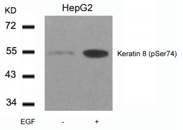 Anti-phospho-Keratin 8 (Ser74)