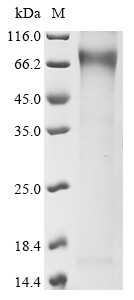 Low-density lipoprotein receptor-related protein 2 (LRP2), partial, human, recombinant