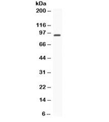 Anti-STAT6