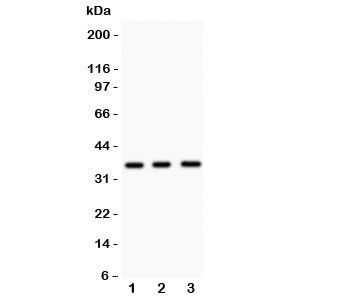 Anti-Nkx2-5