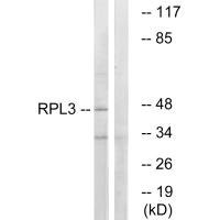 Anti-RPL3