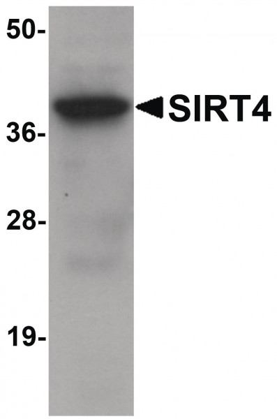 Anti-SIRT4
