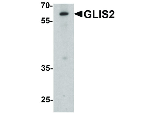 Anti-GLIS2