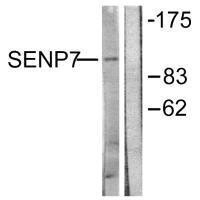 Anti-SENP7