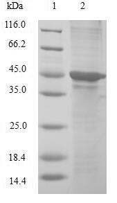 Cold-inducible RNA-binding protein (CIRBP), human, recombinant