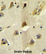 Anti-Potassium Chloride Cotransporter / KCC2