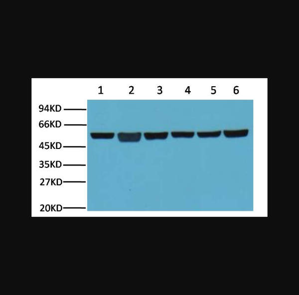 Anti-beta-Tubulin, monoclonal
