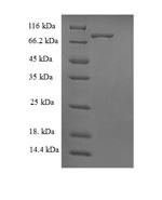 BRISC complex subunit Abro1 (FAM175B), human, recombinant