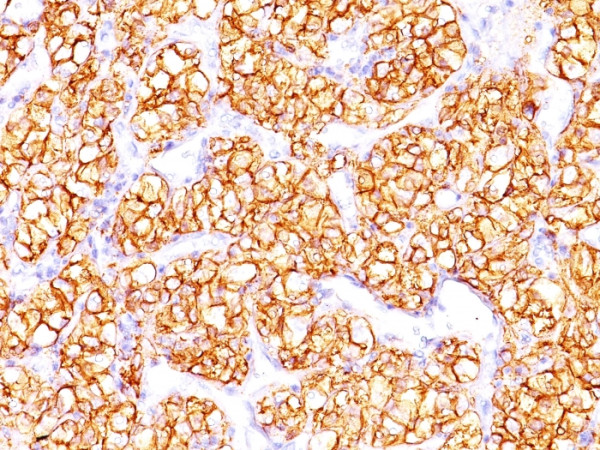 Anti-Proximal Nephrogenic Antigen (Carbonic Anhydrase IX), clone PN-15