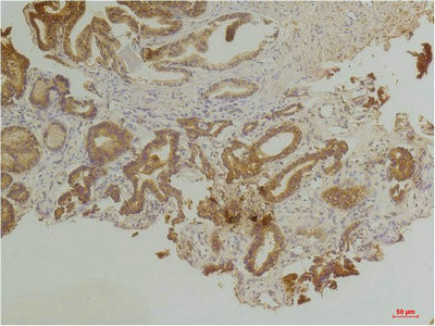 Anti-EDNRB