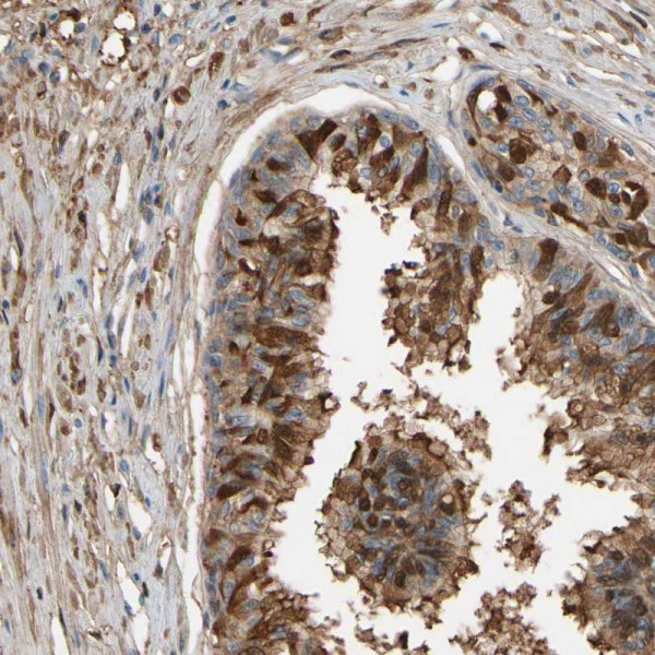 Anti-CSMD2