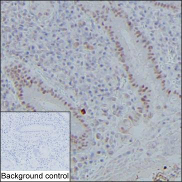 Anti-NIPBL