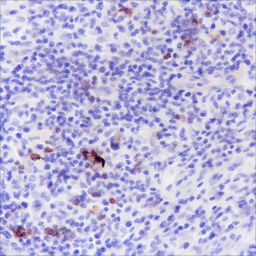 Anti-Recombinant CD134/OX40, clone A157