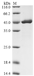 Low affinity immunoglobulin epsilon Fc receptor (FCER2), partial, human, recombinant