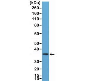 Anti-MyD88 / N-Terminal (recombinant antibody), clone RM306