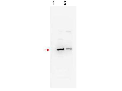 Anti-TrCP2 beta