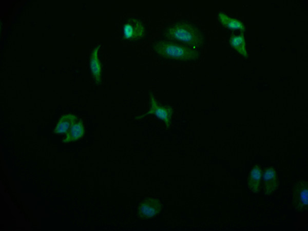 Anti-USP24 Recombinant Monoclonal, clone 11E3
