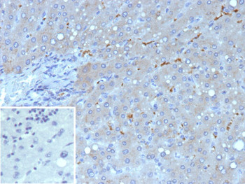 Anti-HNF1B / Transcription factor HNF1 beta, clone HNF1B/9519