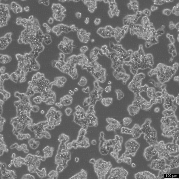 ZR-75-1 Cells