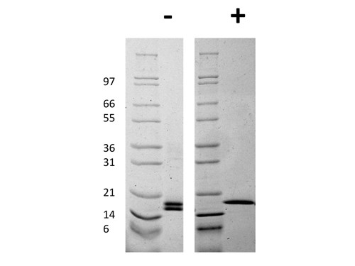 Fibroblast Growth Factor basic