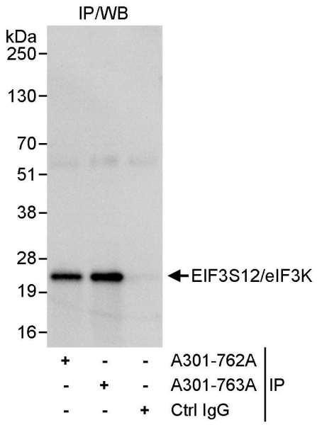 Anti-eIF3K/EIF3S12