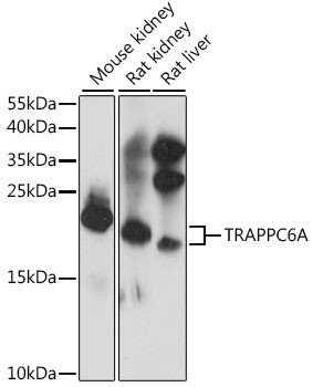 Anti-TRAPPC6A
