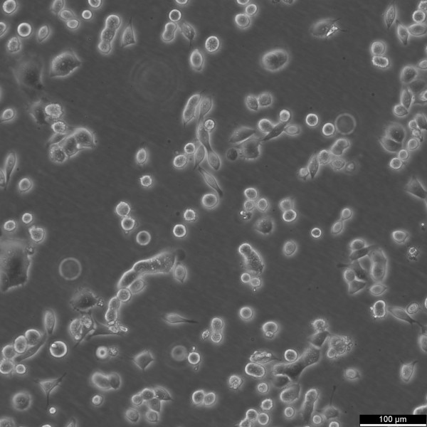 NCI-H1993 Cells