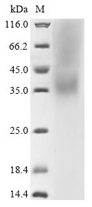 Spike glycoprotein (S), partial, human coronavirus HKU1, recombinant
