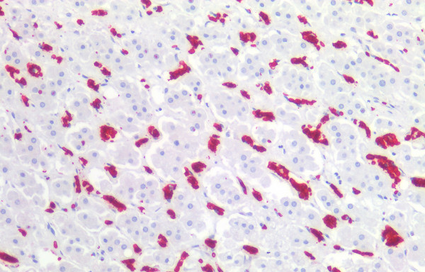 Anti-Glycophorin A, clone HIR2