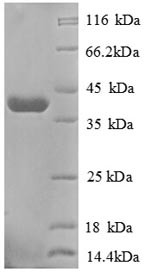 Golgi membrane protein 1 (GOLM1), partial, human, recombinant