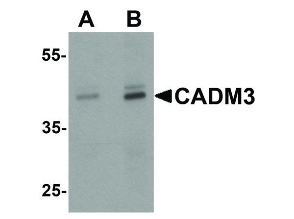 Anti-CADM3