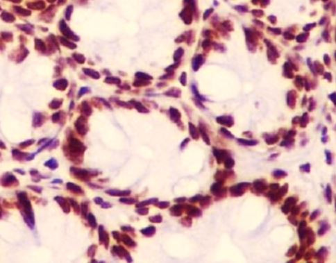 Anti-Histone H2A hydroxyl (Tyr39)