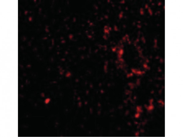 Anti-TEM7