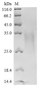 Parathyroid hormone/parathyroid hormone-related peptide receptor (Pth1r), partial, recombinant Dog