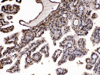 Anti-PNP / Purine Nucleoside Phosphorylase