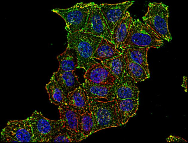 Anti-Transferrin receptor, clone MEM-75