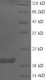 Bis (5'-adenosyl)-triphosphatase (FHIT), human, recombinant