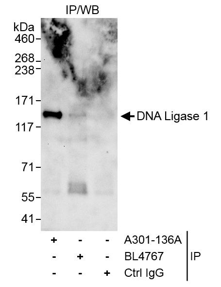 Anti-DNA Ligase 1