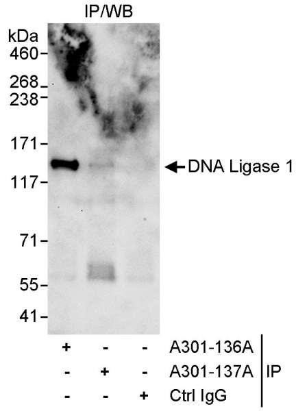 Anti-DNA Ligase 1