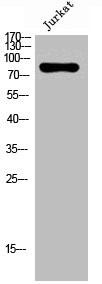 Anti-NOX5