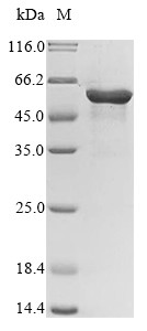 Paired box protein Pax-8 (PAX8), human, recombinant