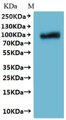 Envelope glycoprotein (GP), partial-VLPs, Crimean-Congo hemorrhagic fever virus, recombinant